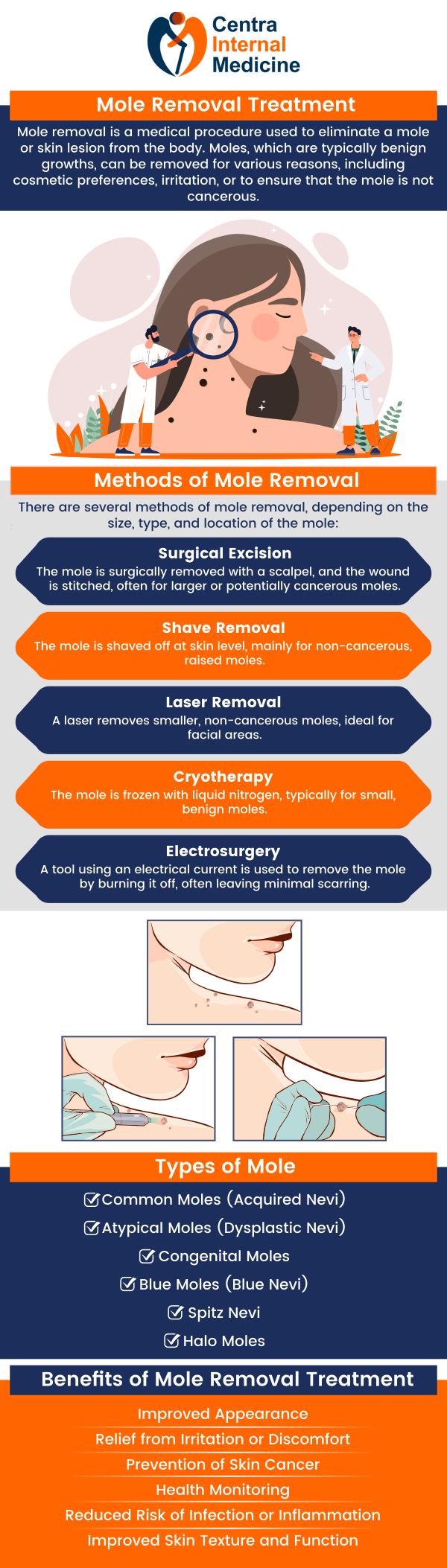We offer safe and effective mole removal treatments. Whether for cosmetic reasons or concerns about skin health, we provide personalized care to ensure the best results. Dr. Manish M.D., will assess your mole and recommend the most appropriate removal technique, helping you achieve smoother, healthier skin. For more information, please contact us or schedule an appointment online. We have convenient locations in Sun City, AZ, Phoenix, AZ, Prescott, AZ, and Buckeye, AZ. We offer safe and effective mole removal treatments. Whether for cosmetic reasons or concerns about skin health, we provide personalized care to ensure the best results. Dr. Manish M.D., will assess your mole and recommend the most appropriate removal technique, helping you achieve smoother, healthier skin. For more information, please contact us or schedule an appointment online. We have convenient locations in Sun City, AZ, Phoenix, AZ, Prescott, AZ, and Buckeye, AZ.