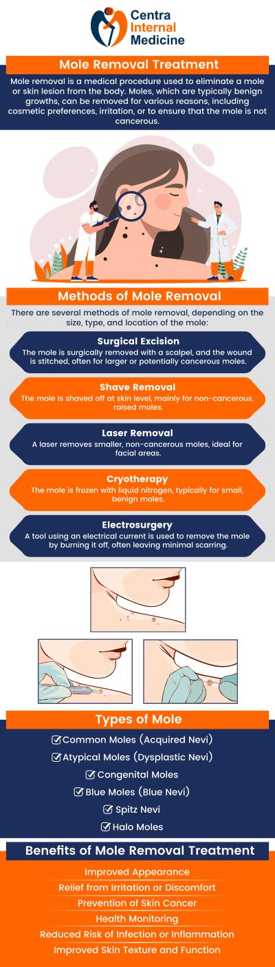 We offer safe and effective mole removal treatments. Whether for cosmetic reasons or concerns about skin health, we provide personalized care to ensure the best results. Dr. Manish M.D., will assess your mole and recommend the most appropriate removal technique, helping you achieve smoother, healthier skin. For more information, please contact us or schedule an appointment online. We have convenient locations in Sun City, AZ, Phoenix, AZ, Prescott, AZ, and Buckeye, AZ. We offer safe and effective mole removal treatments. Whether for cosmetic reasons or concerns about skin health, we provide personalized care to ensure the best results. Dr. Manish M.D., will assess your mole and recommend the most appropriate removal technique, helping you achieve smoother, healthier skin. For more information, please contact us or schedule an appointment online. We have convenient locations in Sun City, AZ, Phoenix, AZ, Prescott, AZ, and Buckeye, AZ.