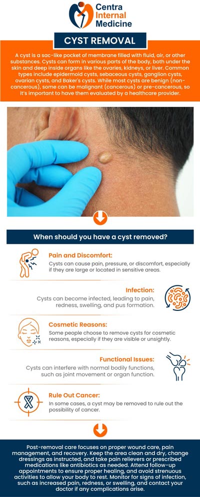 Common questions asked by patients: What is the main cause of a cyst? Why do cysts need to be removed? What does a cyst look like? How to remove a cyst? For more information, contact us or request an appointment online. We have convenient locations to serve you in Arizona. We serve patients from Sun City AZ, Phoenix AZ, Prescott AZ, Buckeye AZ, Westpark AZ, Liberty AZ, Peoria AZ, Glendale AZ, Diamond Valley AZ, Iron Springs AZ, Bumstead AZ, EI Mirage AZ, and surrounding areas.