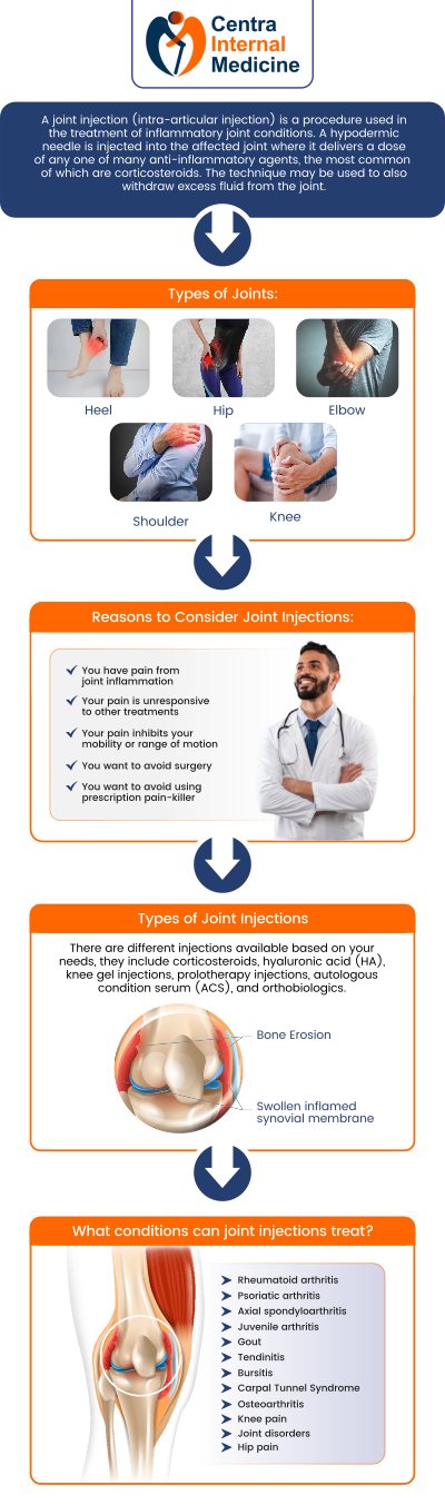 Joint injections are provided by Dr. Manish, MD, at Centra Internal Medicine to reduce pain and inflammation in afflicted joints, which are frequently brought on by injuries or illnesses like arthritis. With these injections, patients can have more focused relief, more mobility, and a decreased need for more involved therapies like surgery. For more information, contact us or request an appointment online. We are conveniently located at 13000 N. 103rd Avenue Suite 60, Sun City, AZ 85351.