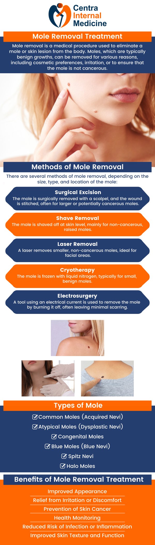 We offer safe and effective mole removal treatments. Whether for cosmetic reasons or concerns about skin health, we provide personalized care to ensure the best results. Dr. Manish M.D., will assess your mole and recommend the most appropriate removal technique, helping you achieve smoother, healthier skin. For more information, contact us or request an appointment online. We are located at 6036 North 19th Avenue Suite 502, Phoenix, AZ 85015.