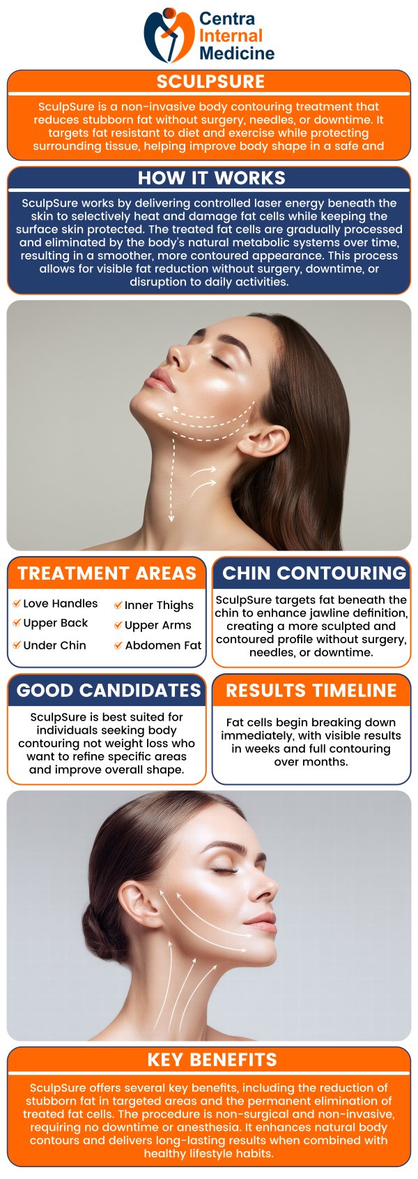 When patients want to enhance their body shape without surgery, Centra Internal Medicine offers SculpSure as the smart choice for non-surgical fat reduction. Dr. Manish Sahni, M.D., and his skilled team provide personalized treatment plans that target stubborn fat areas with minimal downtime. Same-day appointments are available, allowing patients to start their transformation quickly and conveniently, without the need for invasive procedures. For more information, please contact us or schedule an appointment online. We have convenient locations in Sun City, AZ, Phoenix, AZ, Prescott, AZ, and Buckeye, AZ. When patients want to enhance their body shape without surgery, Centra Internal Medicine offers SculpSure as the smart choice for non-surgical fat reduction. Dr. Manish Sahni, M.D., and his skilled team provide personalized treatment plans that target stubborn fat areas with minimal downtime. Same-day appointments are available, allowing patients to start their transformation quickly and conveniently, without the need for invasive procedures. For more information, please contact us or schedule an appointment online. We have convenient locations in Sun City, AZ, Phoenix, AZ, Prescott, AZ, and Buckeye, AZ.