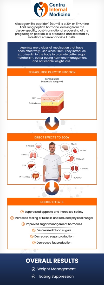Semaglutide GLP-1 injections are an effective tool for medical weight loss, aiding significant and sustainable weight reduction. As a GLP-1 receptor agonist, it regulates appetite and improves blood sugar control, making it suitable for those with obesity or related health issues. Consulting Dr. Manish Sahni, MD is essential for appropriate use, dosage guidance, and monitoring for effectiveness and safety. For more information, contact us or request an appointment online. We are conveniently located at 6036 North 19th Avenue, Suite 502, Phoenix, AZ 85015.